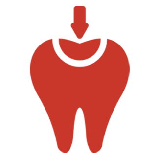 Bonded Fillings